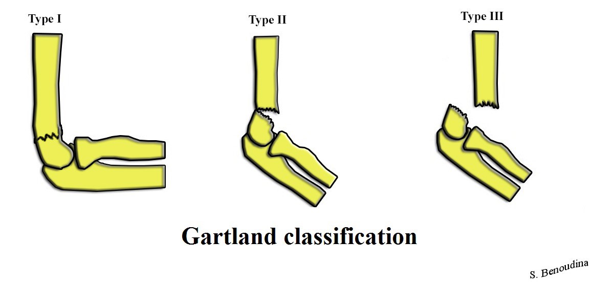 garland class